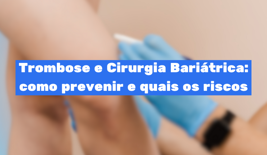 Trombose e Cirurgia Bariátrica: como prevenir e quais os riscos