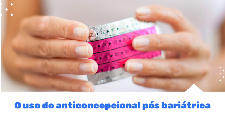 Após a cirurgia bariátrica, o uso de anticoncepcionais pode ser uma preocupação para muitas mulheres. Descubra as melhores opções e cuidados para o pós-operatório.