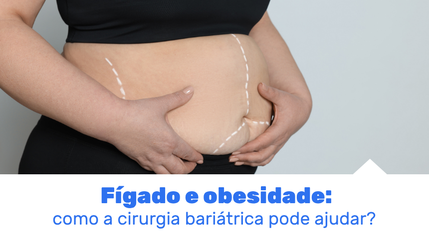 Entenda a relação entre obesidade e gordura no fígado, o que é MASLD e como a cirurgia bariátrica pode contribuir para a saúde hepática.